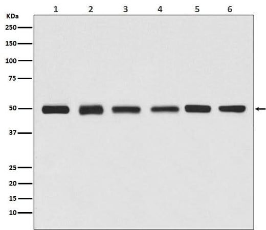 Anti-beta Tubulin Rabbit Monoclonal Antibody Boster Bio
