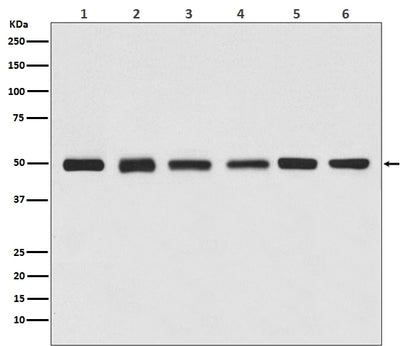 Anti-beta Tubulin Rabbit Monoclonal Antibody Boster Bio