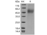 Recombinant Mouse CD19/Leu-12 Protein (His Tag) - ABMIUM