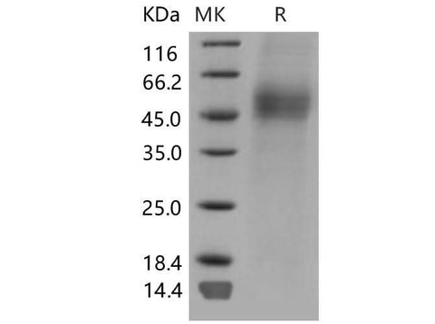 Recombinant Mouse CD19/Leu-12 Protein (His Tag) - ABMIUM