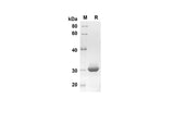 SDS-PAGE analysis of Human S100A1 proteins, 2 μg/lane of Recombinant Human S100A1 proteins was resolved with SDS-PAGE under reducing conditions, showing bands at 30.3 kDa.