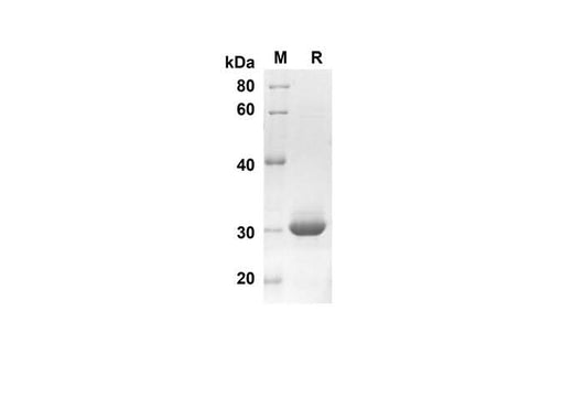 SDS-PAGE analysis of Human S100A1 proteins, 2 μg/lane of Recombinant Human S100A1 proteins was resolved with SDS-PAGE under reducing conditions, showing bands at 30.3 kDa.