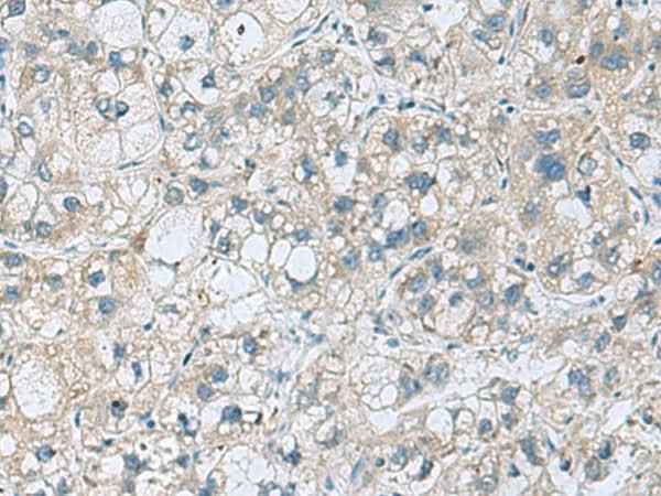 Anti-Human/Mouse/Rat KCNJ2 Antibody