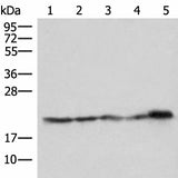 Western blot analysis of Hela HepG2 Jurkat and PC3 cell Mouse kidney tissue lysates using ATP5PD Polyclonal Antibody at dilution of 1:550