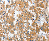 Anti-Human/Mouse CHMP4B Antibody - ABMIUM