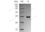 Recombinant Human HGPRT/HPRT1 Protein (His Tag) - ABMIUM
