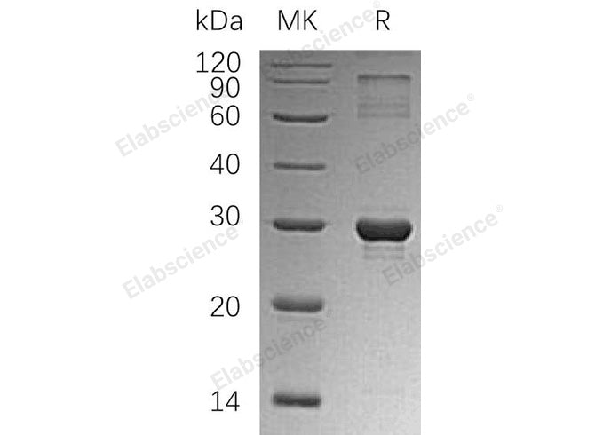 Recombinant Human HGPRT/HPRT1 Protein (His Tag) - ABMIUM