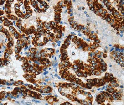 Anti-Human/Mouse ASB4 Antibody
