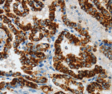 Anti-Human/Mouse ASB4 Antibody - ABMIUM