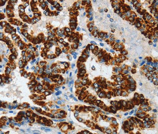 Anti-Human/Mouse ASB4 Antibody - ABMIUM