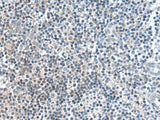 Immunohistochemistry of paraffin-embedded Human tonsil tissue using FAM107B Polyclonal Antibody at dilution of 1:160(×200)
