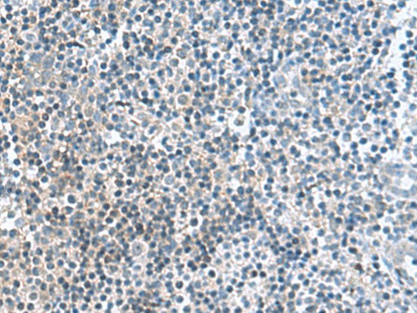 Immunohistochemistry of paraffin-embedded Human tonsil tissue using FAM107B Polyclonal Antibody at dilution of 1:160(×200)