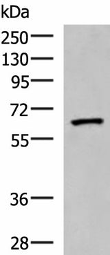 Western blot analysis of Human placenta tissue lysate using PDIA5 Polyclonal Antibody at dilution of 1:1000