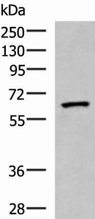 Anti-Human/Mouse/Rat PDIA5 Antibody