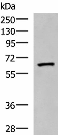 Western blot analysis of Human placenta tissue lysate using PDIA5 Polyclonal Antibody at dilution of 1:1000