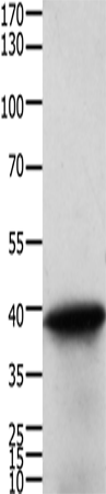 Anti-Human TPM2 Antibody - ABMIUM