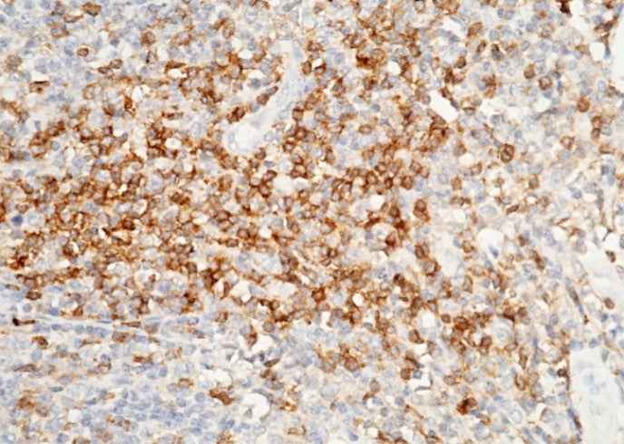 Anti-Human/Cynomolgus CD4 Antibody [A1111] - ABMIUM