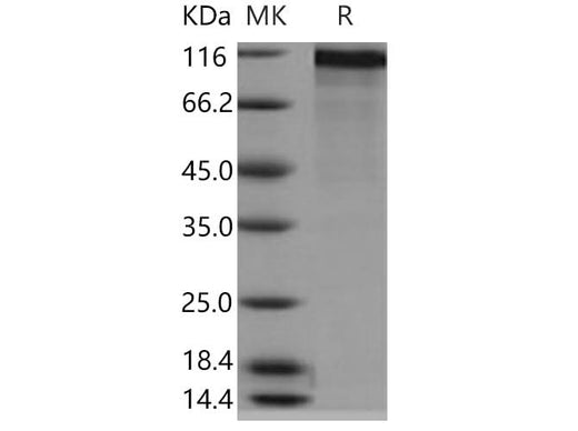 > 87 % as determined by reducing SDS-PAGE.