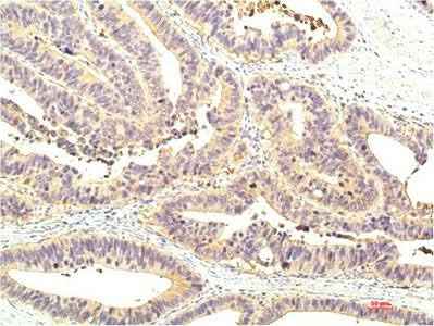 Anti-Human/Mouse/Rat STAT1 Mouse (8H11) Antibody [8H11]
