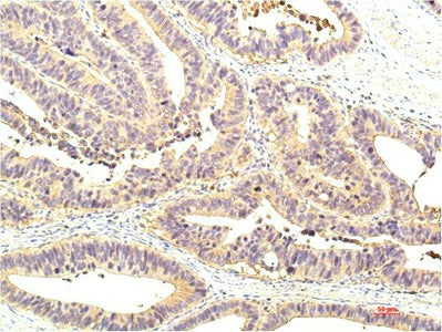 Immunohistochemistry of paraffin-embedded Human colon tissue using STAT1 Monoclonal Antibody at dilution of 1:200.