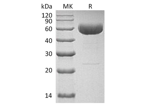 Recombinant Human Interleukin-22/IL-22 Protein (C-hIgG4 Fc) - ABMIUM