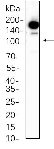 Anti-Human/Mouse/Rat Met Antibody [B1096] - ABMIUM
