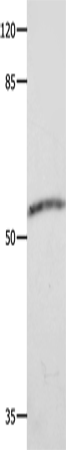 Anti-Human/Mouse/Rat CAP2 Antibody - ABMIUM