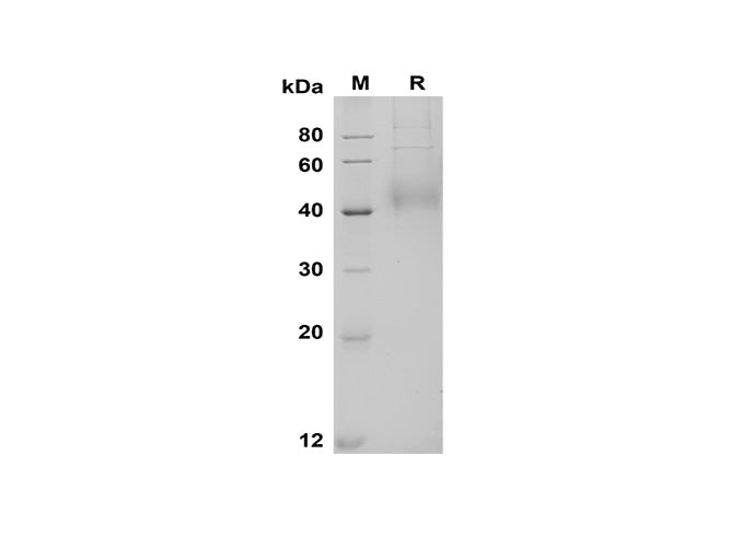 SDS-PAGE analysis of Human TFPI proteins, 2 μg/lane of Recombinant Human TFPI proteins was resolved with SDS-PAGE under reducing conditions, showing bands at 42 kDa.