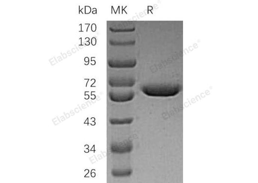 Recombinant Human Arylsulfatase A/ARSA Protein (His Tag) - ABMIUM