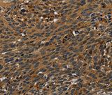Anti-Human PCDHB15 Antibody - ABMIUM