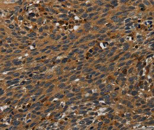 Anti-Human PCDHB15 Antibody