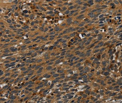 Anti-Human PCDHB15 Antibody - ABMIUM