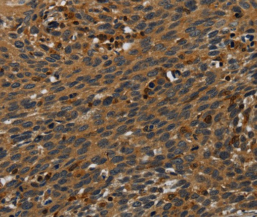 Anti-Human PCDHB15 Antibody - ABMIUM