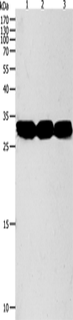 Anti-Human/Mouse NIT2 Antibody - ABMIUM