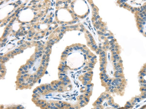 Anti-Human/Mouse/Rat VGF Antibody - ABMIUM