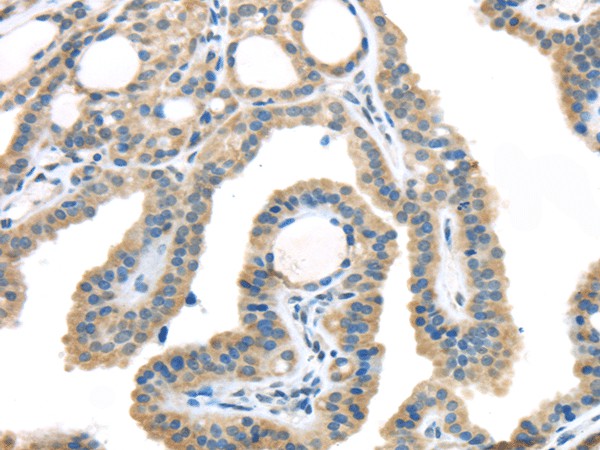 Anti-Human/Mouse/Rat VGF Antibody - ABMIUM