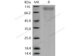 > 92 % as determined by reducing SDS-PAGE.