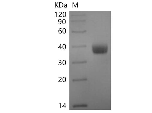 Recombinant SARS-CoV-2 Spike RBD Protein (C-6His-Avi)(Omicron), Biotinylated - ABMIUM