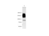 Anti-Human/Mouse CEACAM1 Antibody - ABMIUM