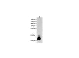 Anti-Mouse C3 Antibody - ABMIUM