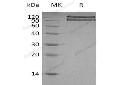 Recombinant Human BAI3 Protein (His Tag) - ABMIUM