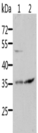 Anti-Human/Mouse/Rat SOCS1 Antibody - ABMIUM