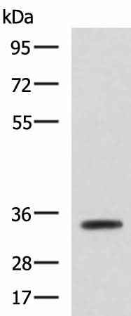 Anti-Human/Mouse ANXA13 Antibody