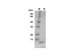 SDS-PAGE analysis of Mouse EGF proteins, 2 μg/lane of Recombinant Mouse EGF proteins was resolved with SDS-PAGE under reducing conditions, showing bands at 10 kDa.