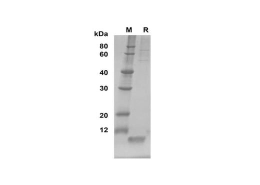 SDS-PAGE analysis of Mouse EGF proteins, 2 μg/lane of Recombinant Mouse EGF proteins was resolved with SDS-PAGE under reducing conditions, showing bands at 10 kDa.