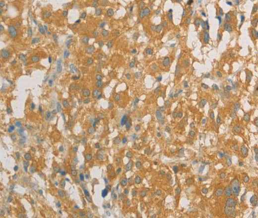 Anti-Human/Mouse/Rat PRPSAP1 Antibody