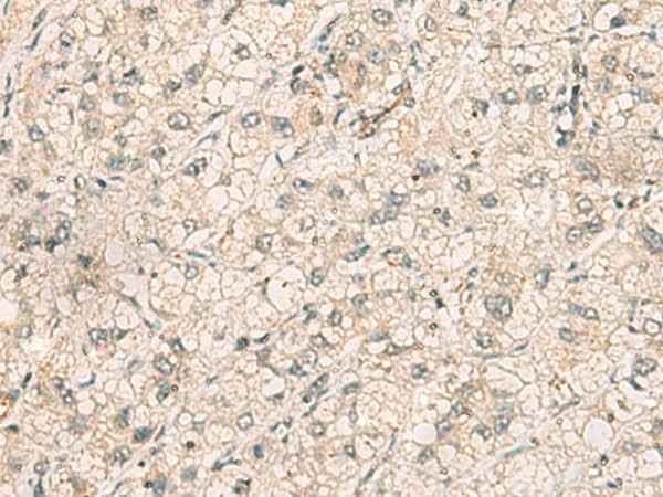 Anti-Human/Mouse TTLL5 Antibody