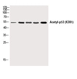 Western Blot analysis of HepG2, 293T-UV, Hela, AD293T, Hela-UV cells using p53 (Acetyl Lys381) Polyclonal Antibody at dilution of 1:1000.