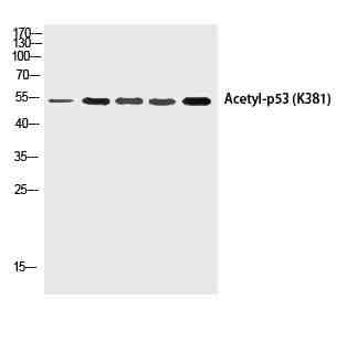 Anti-Human/Mouse/Rat p53 (Acetyl Lys381) Antibody