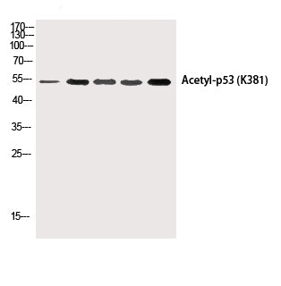 Western Blot analysis of HepG2, 293T-UV, Hela, AD293T, Hela-UV cells using p53 (Acetyl Lys381) Polyclonal Antibody at dilution of 1:1000.